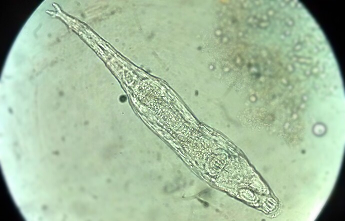 Rotifera_microscopic_view